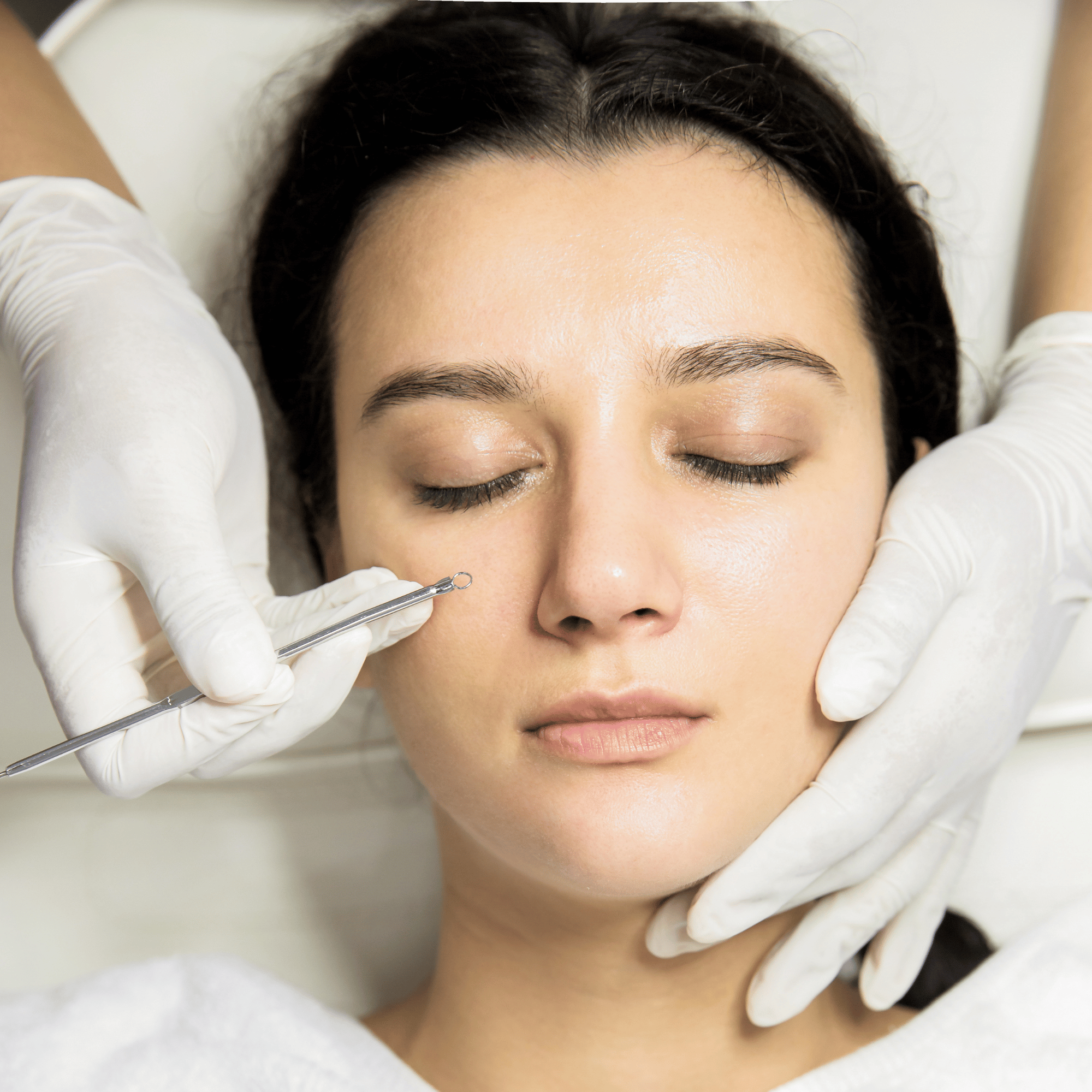 ADD-ON MANUAL EXTRACTION – Spirit Skin Care