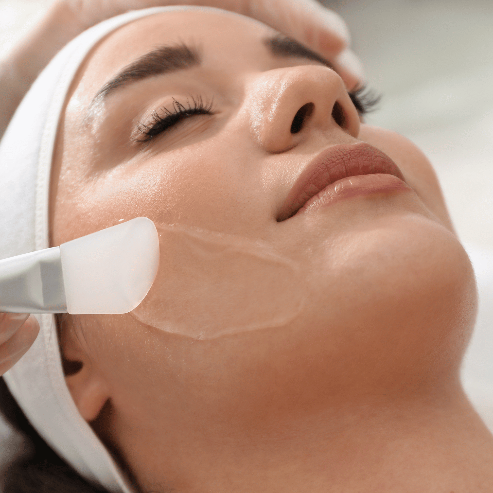 CHEMICAL PEEL