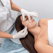 DERMAPLANING