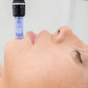 MICRONEEDLING