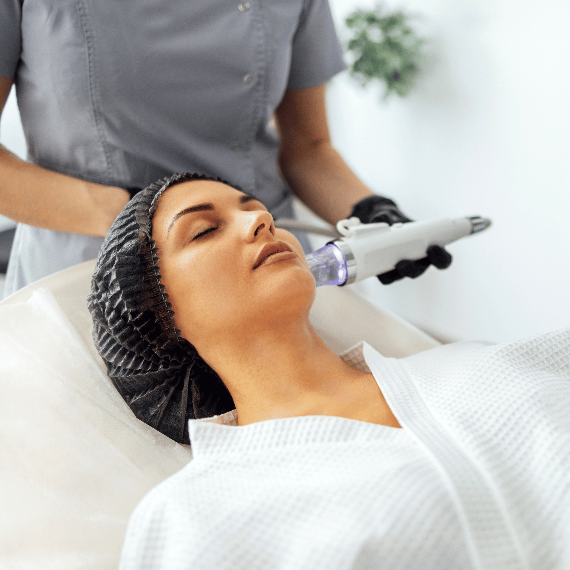 RADIOFREQUENCY MICRONEEDLING FACE