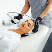 RADIOFREQUENCY MICRONEEDLING FACE